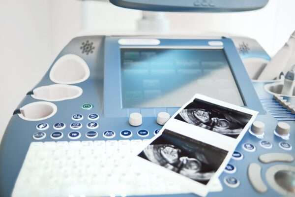 Fertility Pelvic Ultrasound/Follicle Tracking