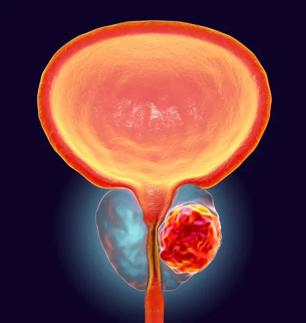 Prostate & Bladder Ultrasound Scan