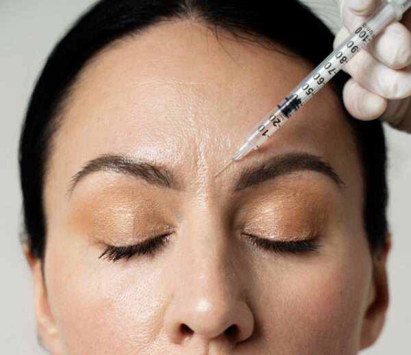Anti-Wrinkle Injection