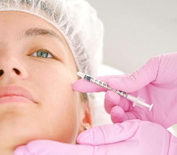 Ellanse – Collagen Stimulation Treatment