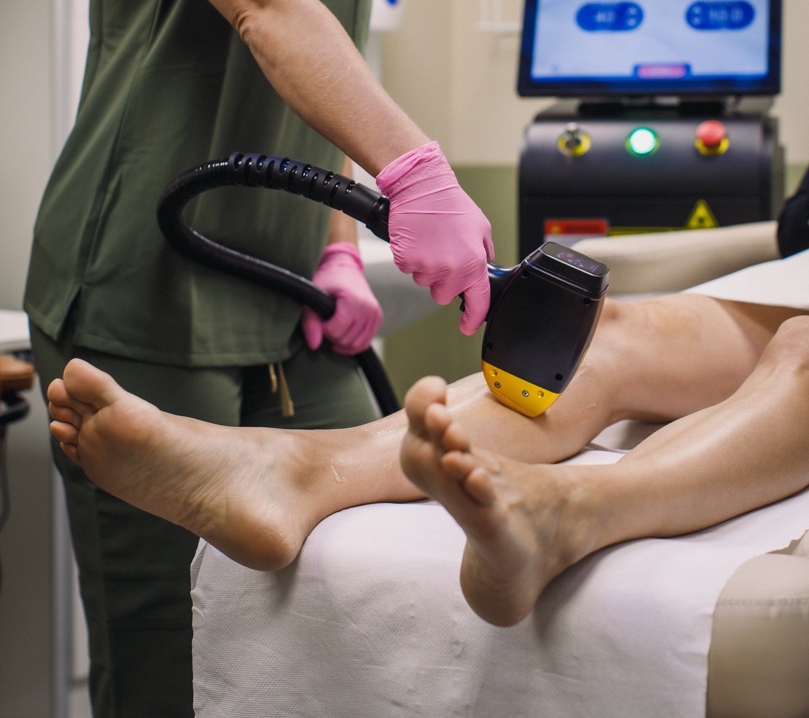 Laser Hair Removal Treatment