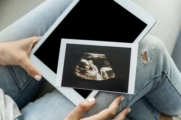 Pregnancy Dating Scan (9 to 15 Weeks) - Medical Room