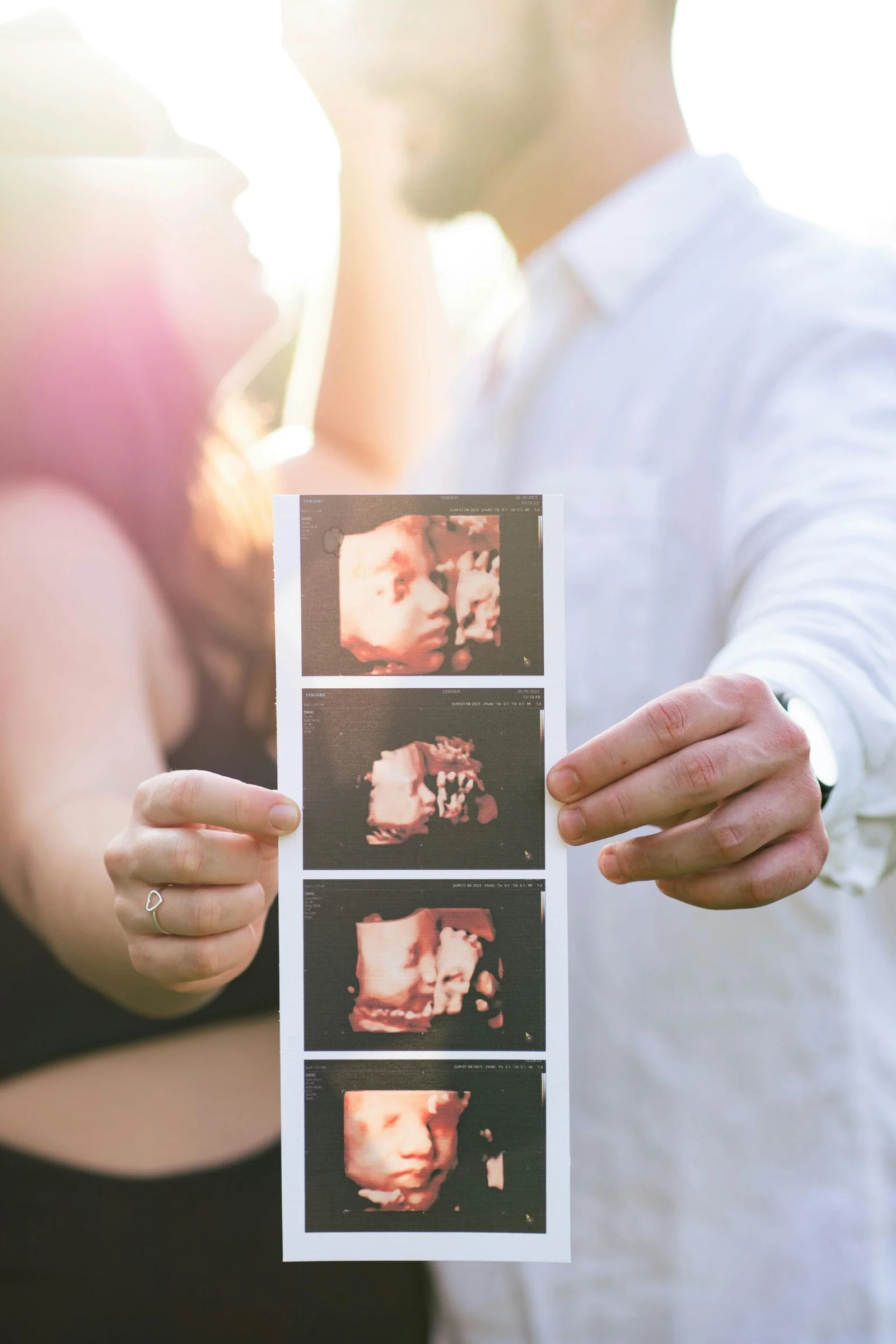 Babybond Reassurance Scan (16 to 36 Weeks)