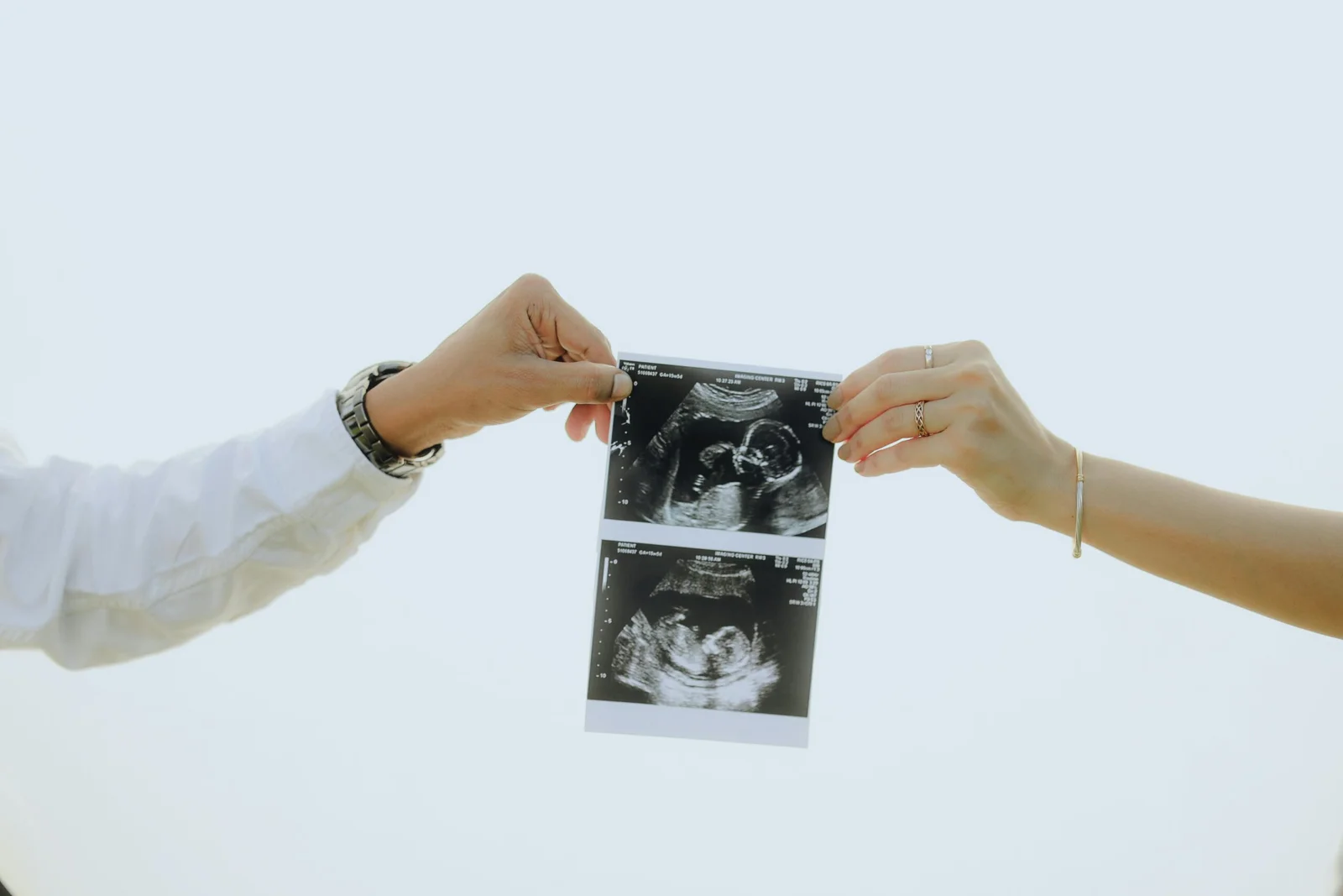 Detailed Anomaly Scan (19 to 24 Weeks)