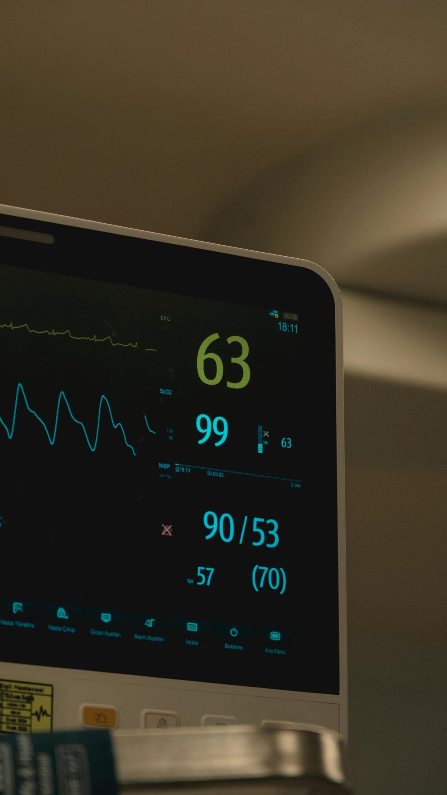 72–120 Hour ECG Monitoring
