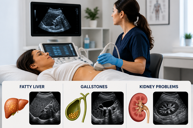 abdominal ultrasound