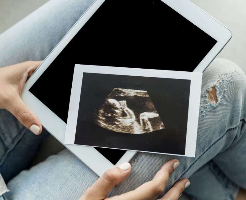 Dating Scan (8-22 Weeks)