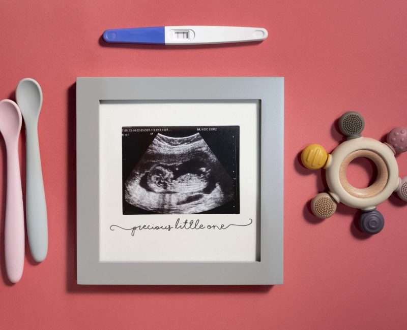 Gender Scan (After 16 Weeks)