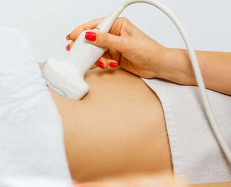 Pelvic Ultrasound (women)/Uterus and Ovaries