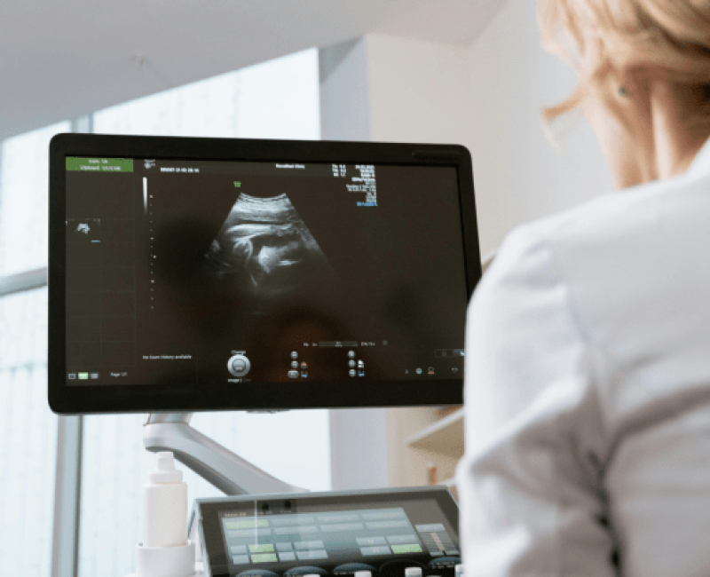 Ultrasound Service