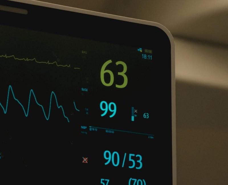 72–120 Hour ECG Monitoring