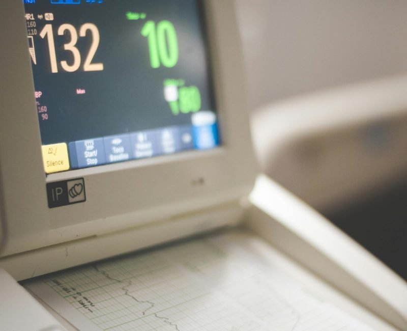 2 Week ECG Monitoring