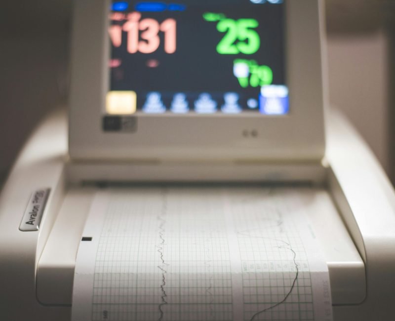24-48 hour ECG - ECG Monitoring