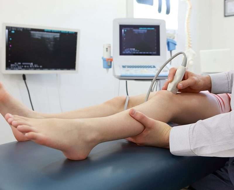 venous-doppler